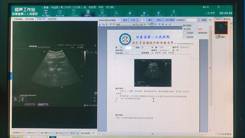 体检前注意事项：揭秘影响体检费用的重要因素